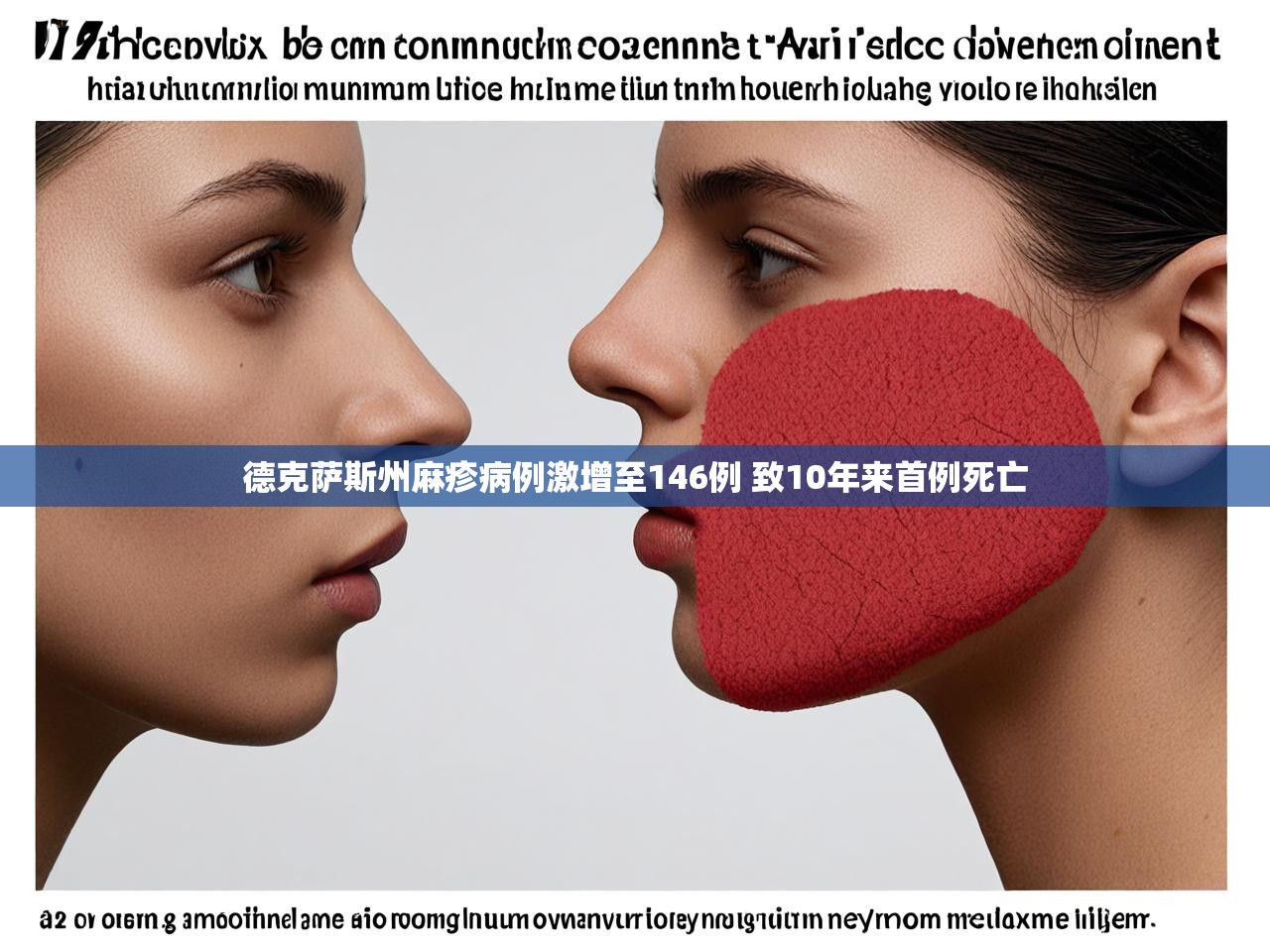 德克萨斯州麻疹病例激增至146例 致10年来首例死亡 德克萨斯州麻疹病例激增至146例 致10年来首例死亡