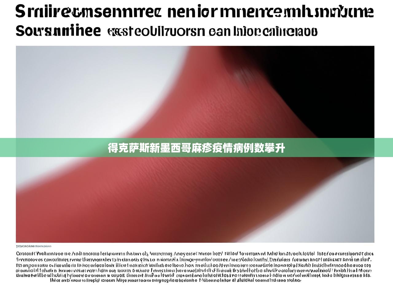 得克萨斯新墨西哥麻疹疫情病例数攀升