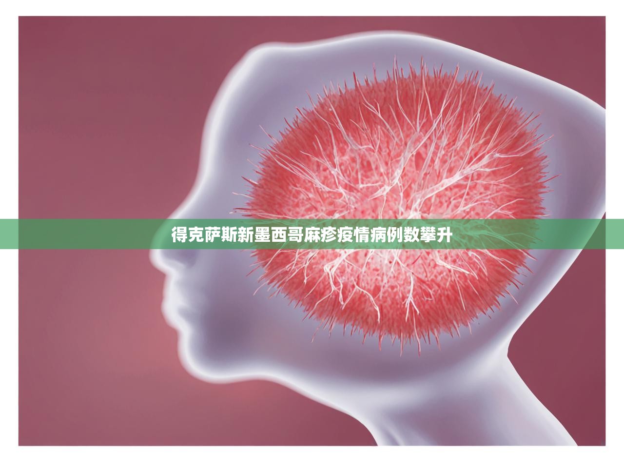 得克萨斯新墨西哥麻疹疫情病例数攀升